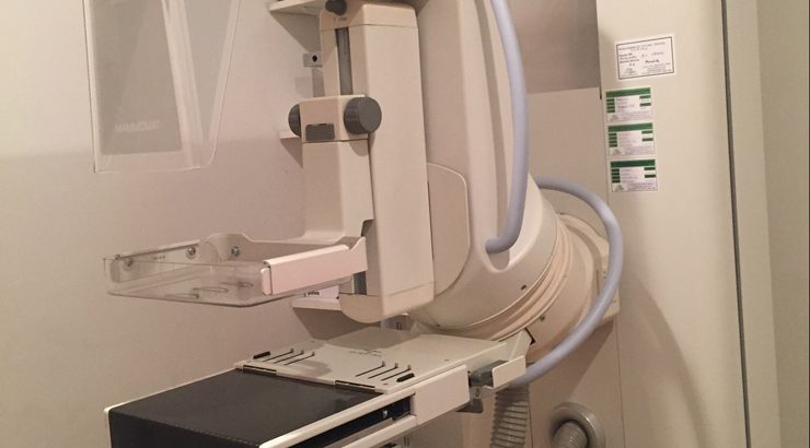 Centro Médico El Carmen implanta la Mamografía Digital Directa Centro Médico El Carmen implanta la Mamografía Digital Directa
